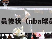 nba球员惨状（nba球员受伤）-第1张图片-足球直播_足球免费在线高清直播_足球视频在线观看无插件-24直播网